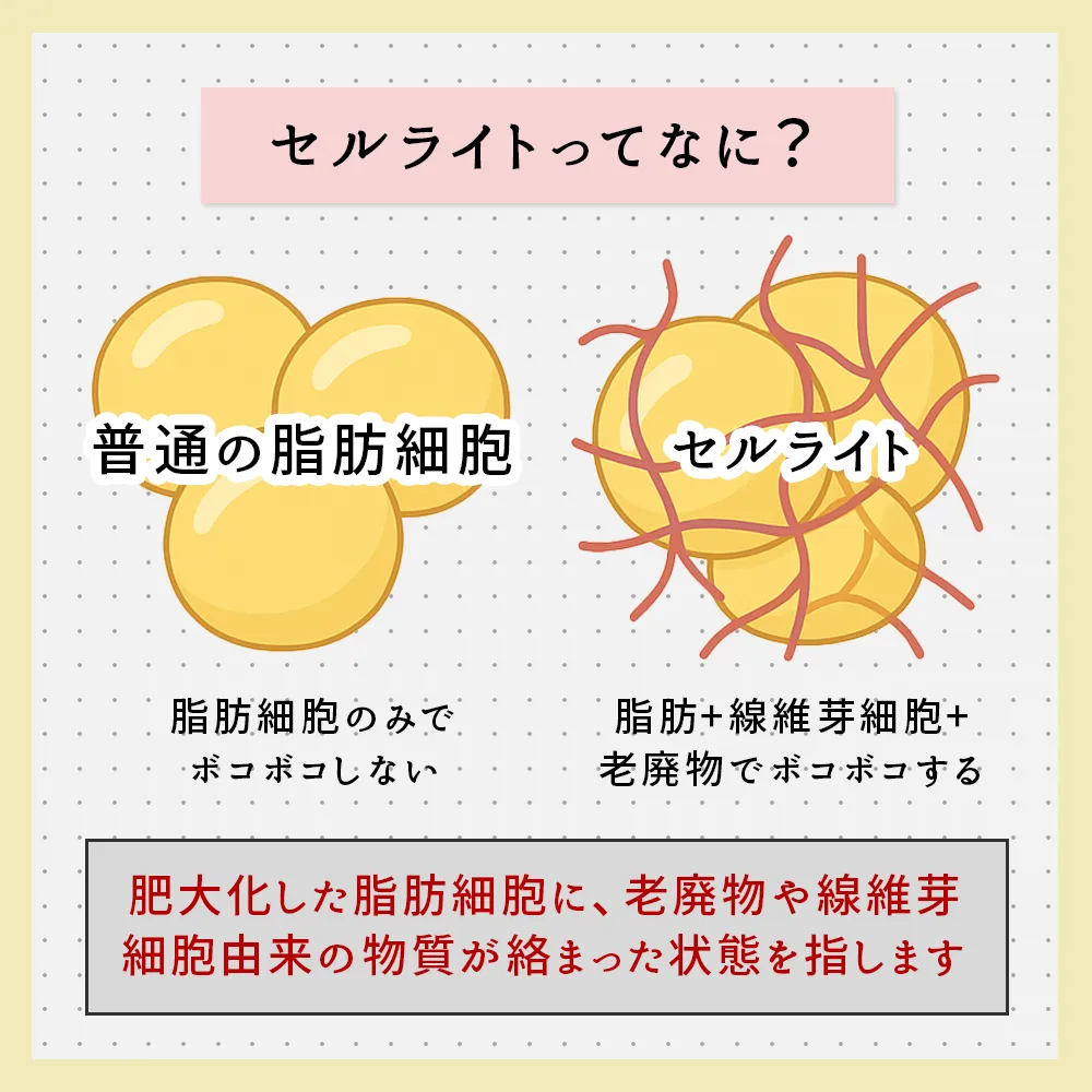 セルライトとは？