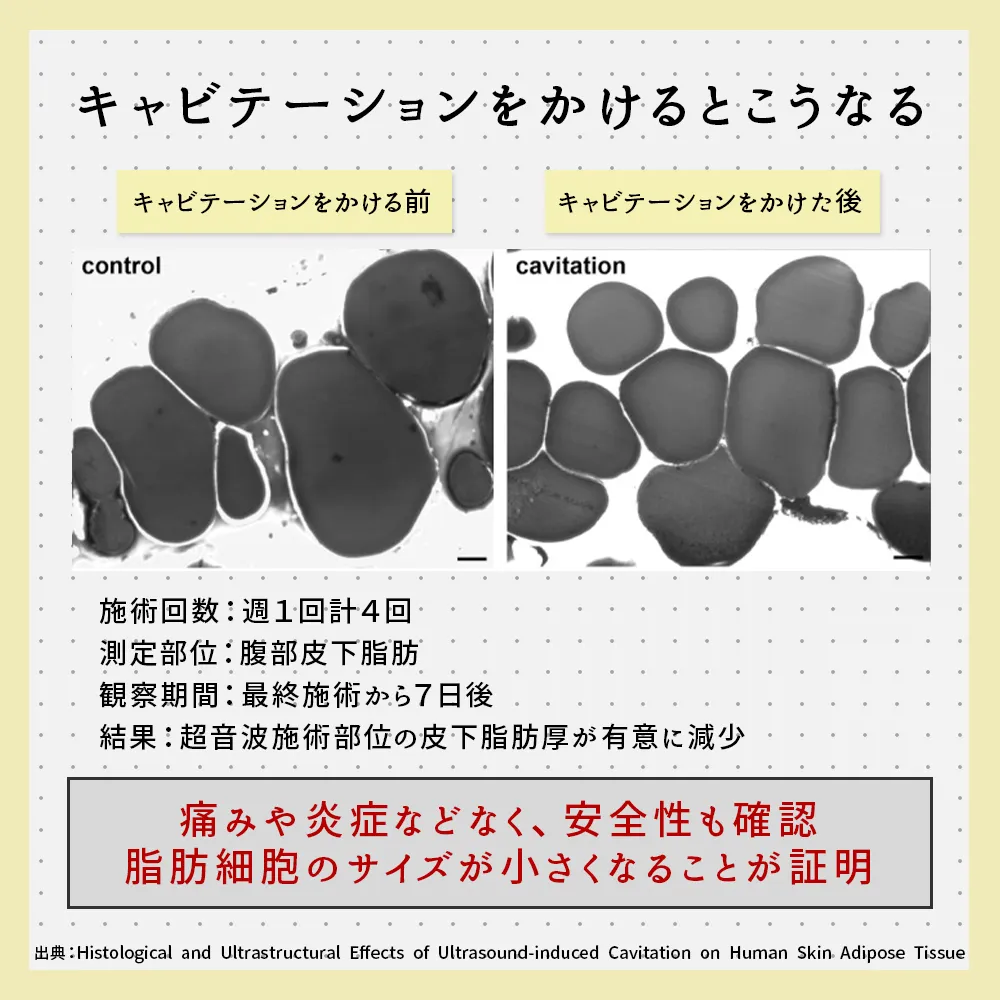 キャビテーションをかけるとこうなる