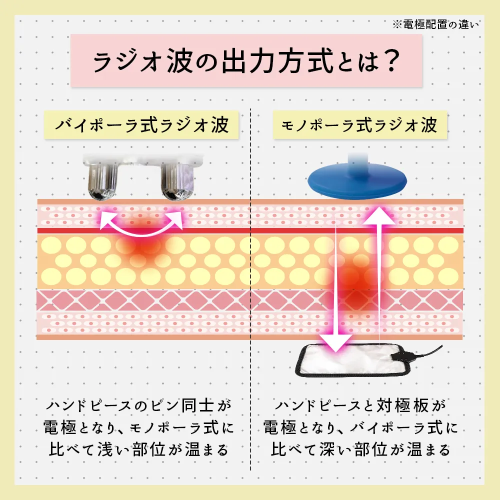ラジオ波の出力方法は何が違う？
