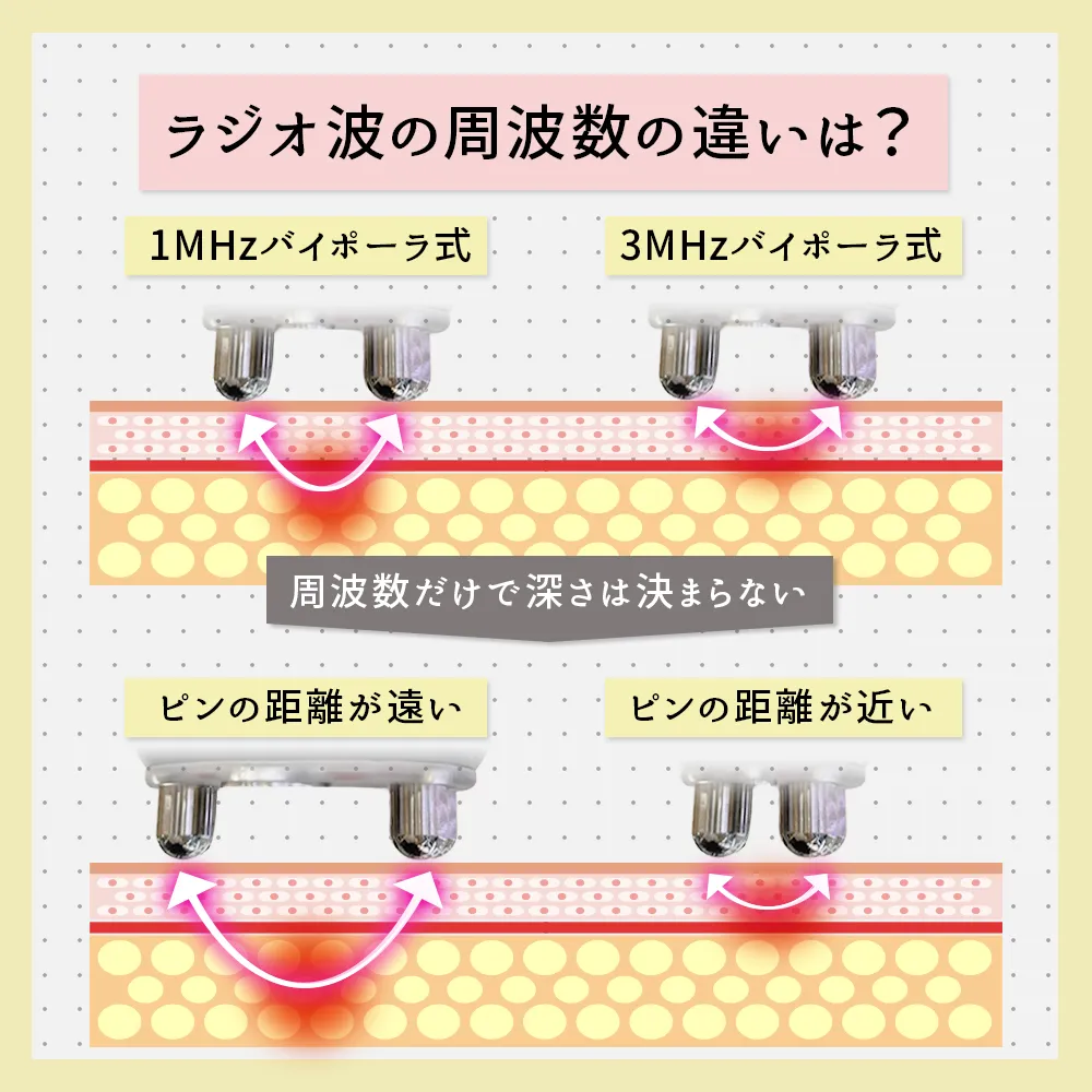 ラジオ波の周波数の違いは？